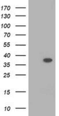 Western Blot: RASSF1 Antibody (OTI2B11) - Azide and BSA Free [NBP2-73786] - HEK293T cells were transfected with the pCMV6-ENTRY control (Left lane) or pCMV6-ENTRY RASSF1 (Right lane) cDNA for 48 hrs and lysed. Equivalent amounts of cell lysates (5 ug per lane) were separated by SDS-PAGE and immunoblotted with anti-RASSF1.