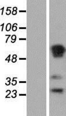 Western Blot: RASSF1 Overexpression Lysate (Adult Normal) [NBP2-05213] Left-Empty vector transfected control cell lysate (HEK293 cell lysate); Right -Over-expression Lysate for RASSF1.