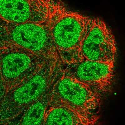 Immunocytochemistry/Immunofluorescence: RASSF2 Antibody [NBP2-13206] - Immunofluorescent staining of human cell line RT4 shows localization to nucleoplasm & cytosol.