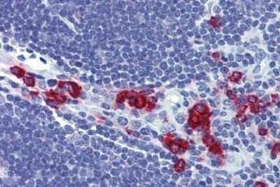 Immunohistochemistry-Paraffin: RASSF2 Antibody [NBP1-52475] - Analysis of anti-RASSF2 antibody with human thymus at concentration 3.75 ug/ml.