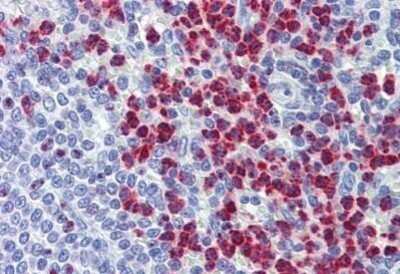 Immunohistochemistry-Paraffin: RASSF2 Antibody [NBP1-52475] - Analysis of anti-RASSF2 antibody with human spleen at concentration 3.75 ug/ml.