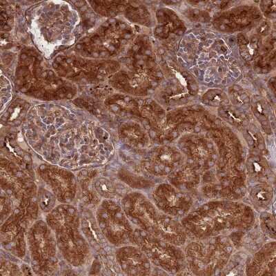 Immunohistochemistry-Paraffin: RASSF2 Antibody [NBP2-13206] - Staining of human kidney shows strong cytoplasmic and membranous positivity in cells of tubules.