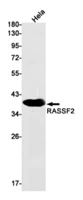 Western Blot: RASSF2 Antibody (S06-2H4) [NBP3-19757] - Western blot detection of RASSF2 in Hela cell lysates using NBP3-19757 (1:1000 diluted). Predicted band size: 38kDa. Observed band size: 38kDa.