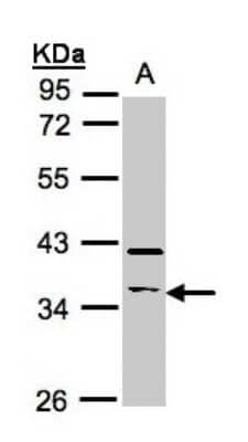 Western Blot: RASSF2 Antibody [NBP1-32571] - Sample(30 ug whole cell lysate)A:Raji  10% SDS PAGE, antibody diluted at 1:500.