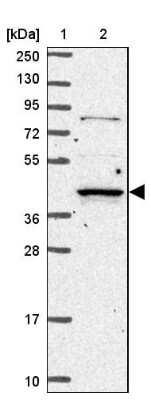 Western Blot: RASSF2 Antibody [NBP2-13206] - Lane 1: Marker  [kDa] 250, 130, 95, 72, 55, 36, 28, 17, 10.  Lane 2: Human cell line RT-4