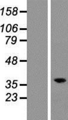 Western Blot: RASSF2 Overexpression Lysate (Adult Normal) [NBP2-07284] Left-Empty vector transfected control cell lysate (HEK293 cell lysate); Right -Over-expression Lysate for RASSF2.