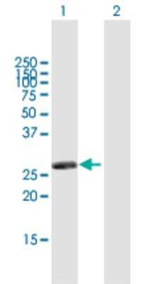 Western Blot: RASSF3 Antibody [H00283349-B01P] - Analysis of RASSF3 expression in transfected 293T cell line by RASSF3 polyclonal antibody.  Lane 1: RASSF3 transfected lysate(26.18 KDa). Lane 2: Non-transfected lysate.