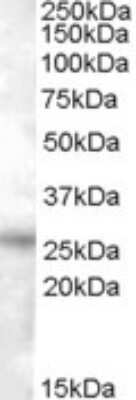 Western Blot: RASSF3 Antibody [NBP1-20967] - Analysis of RASSF3 in Heart lysate (35ug protein in RIPA buffer) with (B) and without (A) blocking with the immunizing peptide using NBP1-20967 at 0.5ug/ml. Primary incubation was 1 hour. Detected by chemiluminescence.