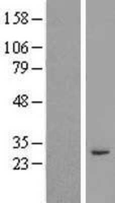 Western Blot: RASSF3 Overexpression Lysate (Adult Normal) [NBP2-04990] Left-Empty vector transfected control cell lysate (HEK293 cell lysate); Right -Over-expression Lysate for RASSF3.