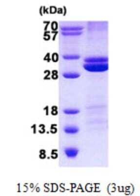 SDS-Page: RASSF3 Protein [NBP2-23398]