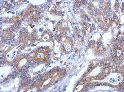 Immunohistochemistry-Paraffin RASSF4 Antibody