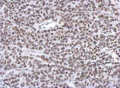 Immunohistochemistry-Paraffin: RASSF4 Antibody [NBP2-20091] - Analysis of paraffin-embedded 59T xenograft, using RASSF4 antibody at 1:500 dilution.