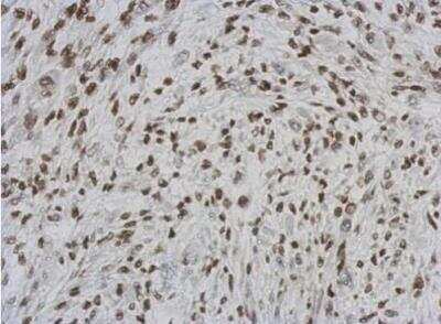 Immunohistochemistry-Paraffin: RASSF4 Antibody [NBP2-20091] -  Analysis of paraffin-embedded C2C12 xenograft, using RASSF4 antibody at 1:500 dilution.