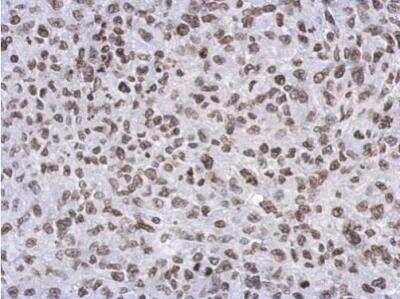 Immunohistochemistry-Paraffin: RASSF4 Antibody [NBP2-20091] - Analysis of paraffin-embedded RT2 xenograft, using RASSF4 antibody at 1:500 dilution.