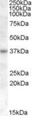 Western Blot: RASSF7 Antibody [NB100-93434] - Analysis using antibody at 1 ug/ml in Jurkat cell lysate (35ug protein in RIPA buffer). Primary incubation was 1 hour. Detected by chemiluminescence.