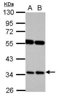 Western Blot: RASSF7 Antibody [NBP2-15091] - Sample (30 ug of whole cell lysate) A: Raji B: K562 10% SDS PAGE; antibody diluted at 1:1000.