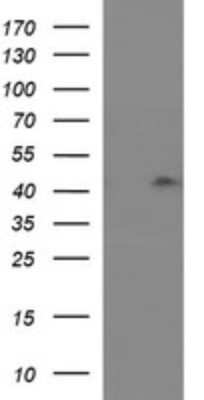 Western Blot: RASSF8 Antibody (1F5) [NBP2-45530] - Analysis of HEK293T cells were transfected with the pCMV6-ENTRY control (Left lane) or pCMV6-ENTRY RASSF8.