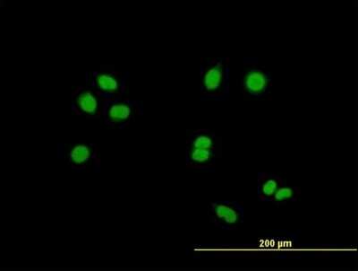 Immunocytochemistry/Immunofluorescence: RASSF8 Antibody [H00011228-B01P] - Analysis of purified antibody to RASSF8 on HeLa cell. (antibody concentration 10 ug/ml)