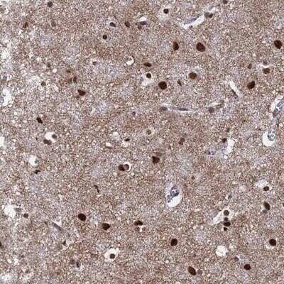 Immunohistochemistry-Paraffin RAVER2 Antibody - BSA Free