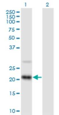 Western Blot: RAX2 Antibody [H00084839-B01P] - Analysis of RAX2 expression in transfected 293T cell line by RAX2 polyclonal antibody.  Lane 1: RAX2 transfected lysate(20.10 KDa). Lane 2: Non-transfected lysate.