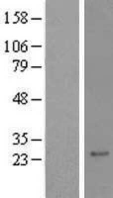 Western Blot: RAX2 Overexpression Lysate (Adult Normal) [NBL1-15183] Left-Empty vector transfected control cell lysate (HEK293 cell lysate); Right -Over-expression Lysate for RAX2.