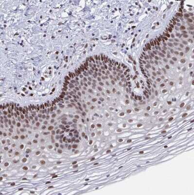 Immunohistochemistry-Paraffin: RB1 Antibody [NBP2-48953] - Staining of human Cervix, uterine shows strong nuclear positivity in squamous epithelial cells.