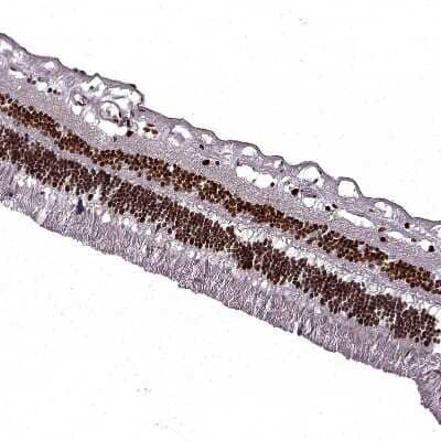 Immunohistochemistry-Paraffin: RB1 Antibody [NBP2-48953] - Staining of human Retina shows strong nuclear positivity in photoreceptor cells, cells in inner nuclear layer and ganglion cells.