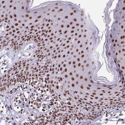 Immunohistochemistry-Paraffin: RB1 Antibody [NBP2-48953] - Staining of human Skin shows strong nuclear positivity in epidermal cells.