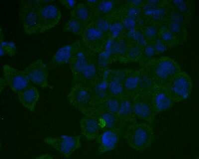 Immunocytochemistry/Immunofluorescence: RB1 Antibody (SY63-03) [NBP2-67453] - ICC staining of RB1 in SW480 cells (green). Formalin fixed cells were permeabilized with 0.1% Triton X-100 in TBS for 10 minutes at room temperature and blocked with 1% Blocker BSA for 15 minutes at room temperature. Cells were probed with the primary ant