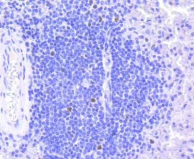 Immunohistochemistry-Paraffin: RB1 Antibody (SY63-03) [NBP2-67453] - Analysis of paraffin-embedded human spleen tissue using anti-Rb antibody. Counter stained with hematoxylin.
