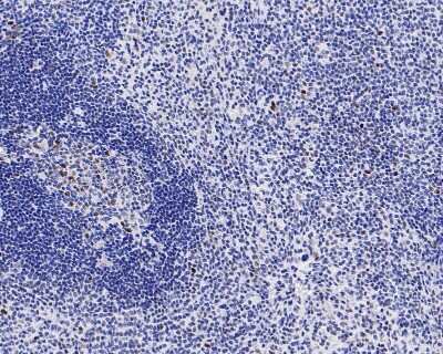 Immunohistochemistry-Paraffin: RB1 Antibody (SY63-03) [NBP2-67453] - Analysis of paraffin-embedded human spleen tissue with Rabbit anti-Rb antibody washed with ddH2O and PBS, and then probed with the primary antibody  at 1/200 dilution for 1 hour at room temperature. The detection was performed using an HRP conjugated compact polymer system. DAB was used as the chromogen. Tissues were counterstained with hematoxylin and mounted with DPX.