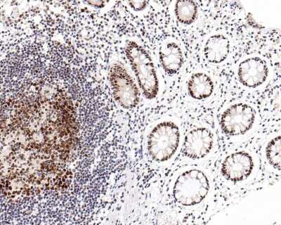 Immunohistochemistry-Paraffin: RB1 Antibody (SY63-03) [NBP2-67453] - Analysis of paraffin-embedded human colon tissue with Rabbit anti-RB1 antibody washed with ddH2O and PBS, and then probed with the primary antibody  at 1/800 dilution for 1 hour at room temperature. The detection was performed using an HRP conjugated compact polymer system. DAB was used as the chromogen. Tissues were counterstained with hematoxylin and mounted with DPX.