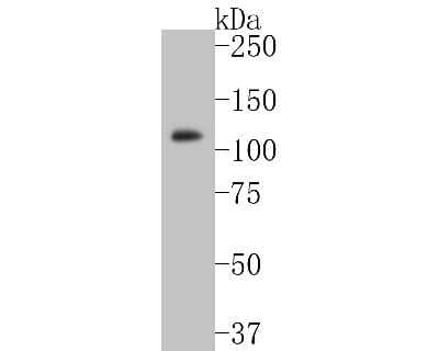 Western Blot: RB1 Antibody (SY63-03) [NBP2-67453] - Western blot analysis of RB1 on mouse lung tissue lysates. Proteins were transferred to a PVDF membrane and blocked with 5% BSA in PBS for 1 hour at room temperature. The primary antibody (1/500) was used in 5% BSA at room temperature for 2 hours. Goat An