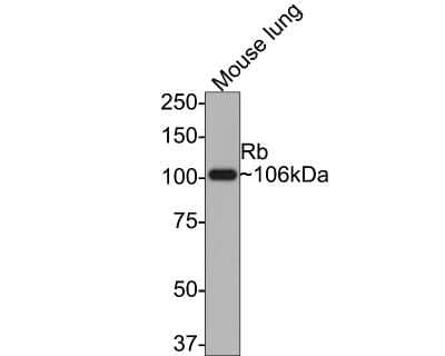 Western Blot: RB1 Antibody (SY63-03) [NBP2-67453] - Analysis of RB1 on mouse lung tissue lysates with Rabbit anti-Rb antibody at 1/500 dilution. Lysates/proteins at 10 ug/Lane. Predicted band size: 106 kDa Observed band size: 106 kDa Exposure time: 2 minutes; 8% SDS-PAGE gel. Proteins were transferred to a PVDF membrane and blocked with 5% NFDM/TBST for 1 hour at room temperature. The primary antibody at 1/500 dilution was used in 5% NFDM/TBST at room temperature for 2 hours. Goat Anti-Rabbit IgG - HRP Secondary Antibody at 1:300,000 dilution was used for 1 hour at room temperature.