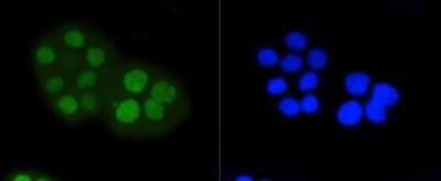 Immunocytochemistry/Immunofluorescence: RB1 [p Ser807] Antibody (SR3-82) [NBP2-67338] - Staining Phospho-Rb(S807) in CRC cells (green). Cells were fixed in paraformaldehyde, permeabilised with 0.25% Triton X100/PBS.