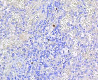 Immunohistochemistry-Paraffin: RB1 [p Ser807] Antibody (SR3-82) [NBP2-67338] - Analysis of paraffin-embedded human spleen tissue using anti-Phospho-Rb(S807) antibody. Counter stained with hematoxylin.