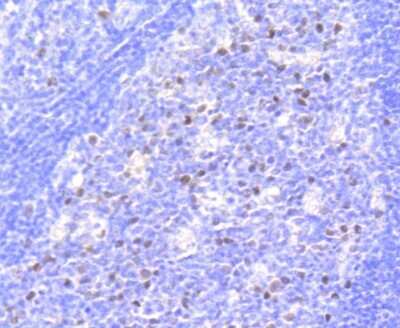 Immunohistochemistry-Paraffin: RB1 [p Ser807] Antibody (SR3-82) [NBP2-67338] - Analysis of paraffin-embedded human tonsil tissue using anti-Phospho-Rb(S807) antibody. Counter stained with hematoxylin.