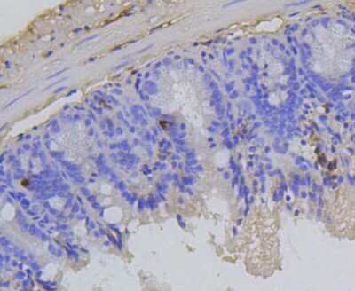 Immunohistochemistry-Paraffin: RB1 [p Ser807] Antibody (SR3-82) [NBP2-67338] - Analysis of paraffin-embedded mouse colon tissue using anti-Phospho-Rb(S807) antibody. Counter stained with hematoxylin.
