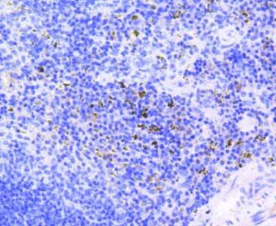 Immunohistochemistry-Paraffin: RB1 [p Ser807] Antibody (SR3-82) [NBP2-67338] - Analysis of paraffin-embedded mouse spleen tissue using anti-Phospho-Rb(S807) antibody. Counter stained with hematoxylin.