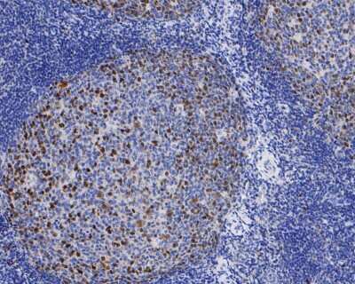 Immunohistochemistry-Paraffin: RB1 [p Ser807] Antibody (SR3-82) [NBP2-67338] - Immunohistochemical analysis of paraffin-embedded human tonsil tissue using anti-RB1 antibody. The section was pre-treated using heat mediated antigen retrieval with sodium citrate buffer (pH 6.0) for 20 minutes. The tissues were blocked in 5% BSA for 30 minutes at room temperature, washed with ddH2O and PBS, and then probed with the primary antibody (ET1602-36, 1/200) for 30 minutes at room temperature. The detection was performed using an HRP conjugated compact polymer system. DAB was used as the chromogen. Tissues were counterstained with hematoxylin and mounted with DPX.