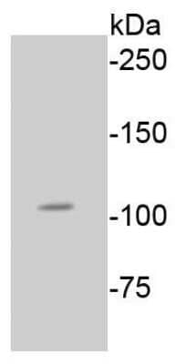 Western Blot: RB1 [p Ser807] Antibody (SR3-82) [NBP2-67338] - Analysis of Phospho-Rb(S807) on A549 cell lysates using anti-Phospho-Rb(S807) antibody at 1/1,000 dilution.