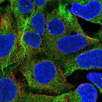 Immunocytochemistry/ Immunofluorescence RB1CC1 Antibody