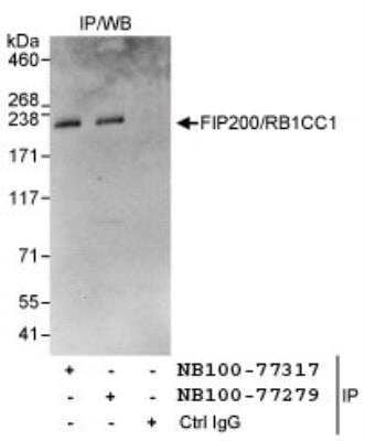 Immunoprecipitation: RB1CC1 Antibody [NB100-77317] - Detection of Human FIP200/RB1CC1 by Western Blot of  Immunoprecipitates. Samples: Whole cell lysate (1 mg for IP,  20% of IP loaded) from HeLa cells. Antibodies: Affinity purified  rabbit anti-FIP200/RB1CC1 antibody NB100-77317 used for IP at  3 mcg/mg lysate. FIP200/RB1CC1 was also immunoprecipitated  by rabbit anti-FIP200/RB1CC1 antibody NB10077279, which  recognizes a downstream epitope. Detection: Chemiluminescence  with an exposure time of 30 seconds.