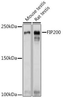 Western Blot: RB1CC1 Antibody [NBP2-93785] - Analysis of extracts of various cell lines, using FIP200 Rabbit pAb at 1:1000 dilution.Secondary antibody: HRP Goat Anti-Rabbit IgG (H+L) at 1:10000 dilution.Lysates/proteins: 25ug per lane.Blocking buffer: 3% nonfat dry milk in TBST.Detection: ECL Basic Kit. Exposure time: 1s.