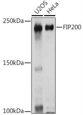 Western Blot RB1CC1 Antibody - Azide and BSA Free