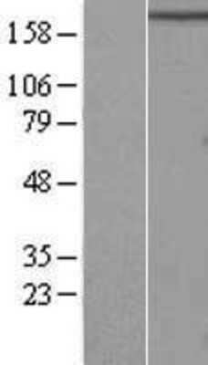 Western Blot RB1CC1 Overexpression Lysate