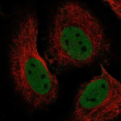 Immunocytochemistry/Immunofluorescence: RBBP4/RbAp48 Antibody [NBP2-56286] - Staining of human cell line HeLa shows localization to nucleoplasm.