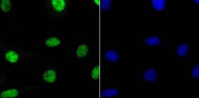 Immunocytochemistry/Immunofluorescence: RBBP4/RbAp48 Antibody (JU37-47) [NBP2-75642] - Staining RbAP48 in SH-SY5Y cells (green). The nuclear counter stain is DAPI (blue). Cells were fixed in paraformaldehyde, permeabilised with 0.25% Triton X100/PBS.