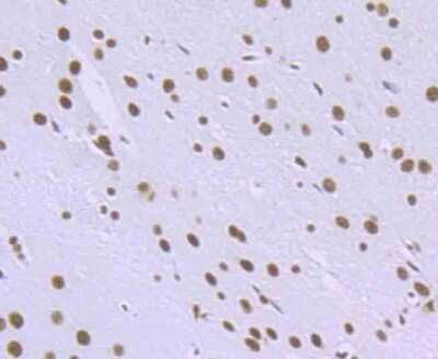 Immunohistochemistry-Paraffin: RBBP4/RbAp48 Antibody (JU37-47) [NBP2-75642] - Analysis of paraffin-embedded rat brain tissue using anti-RbAP48 antibody. Counter stained with hematoxylin.