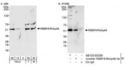 Western Blot: RBBP4/RbAp48 Antibody [NB100-60399] - Whole cell lysate from HeLa (5, 15, and 50 ug for WB; 1 mg for IP, 20% of IP loaded), 293T (T; 50 ug), and mouse NIH3T3 (M; 50 ug) cells. Antibodies:  NB100-60399 used for WB at 0.04 ug/ml (A) and 0.1 ug/ml (B) and used for IP at 3 ug/mg lysate.